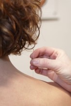 Akupunkturnadel wird in Schulter einer Frau gestochen